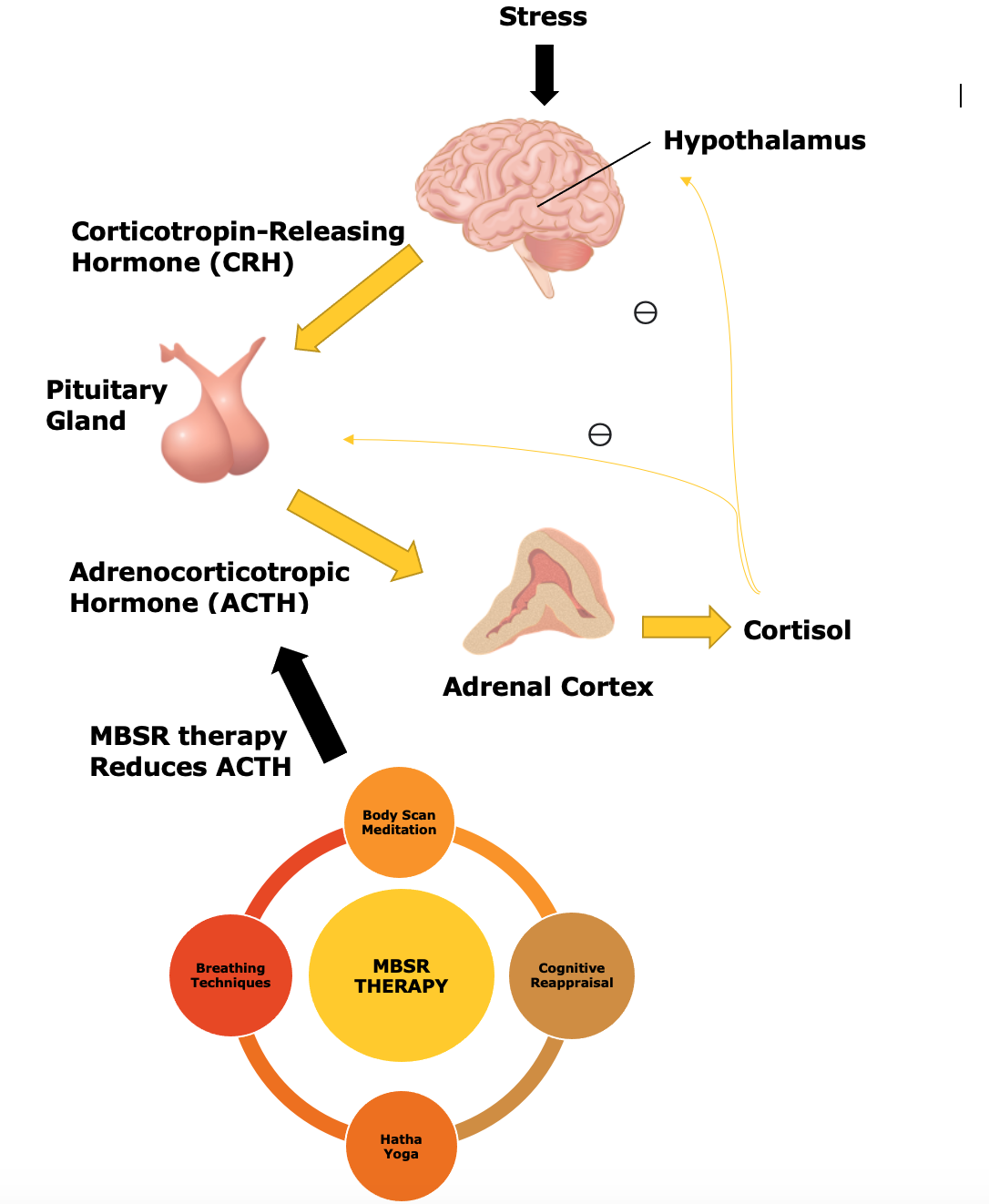 <p>MSBR and Stress