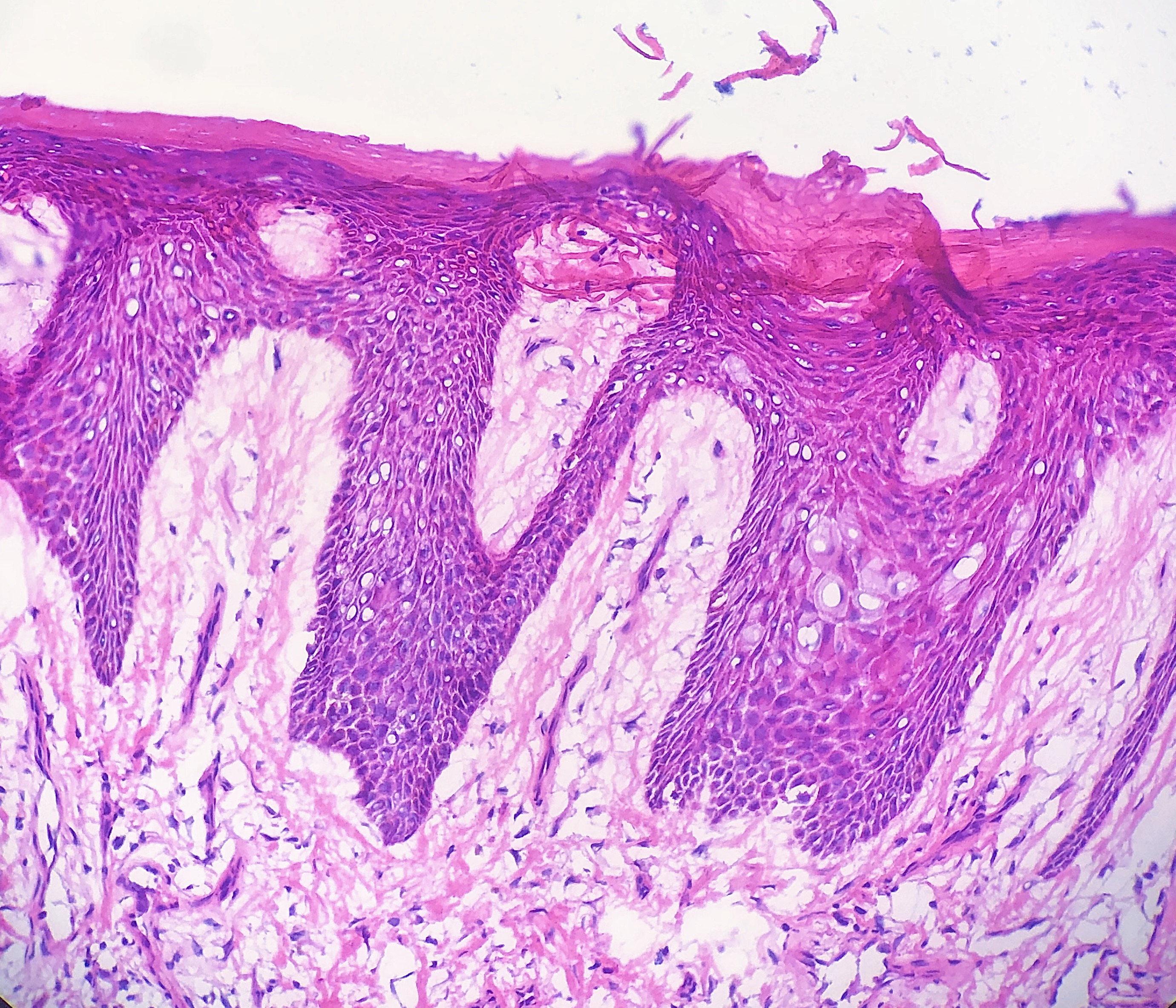 <p>Vacuolar Change