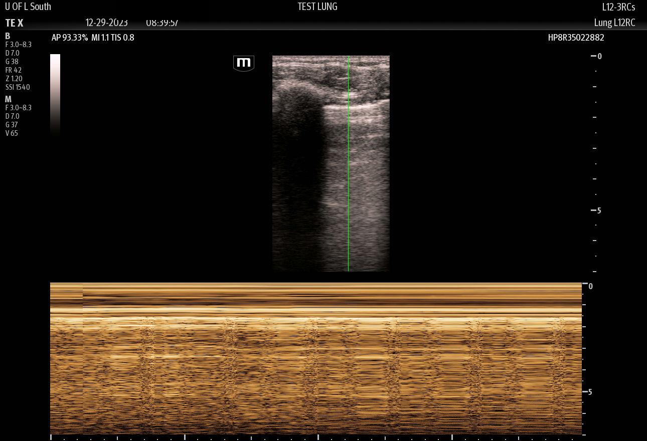 <p>Lung Ultrasound M-Mode