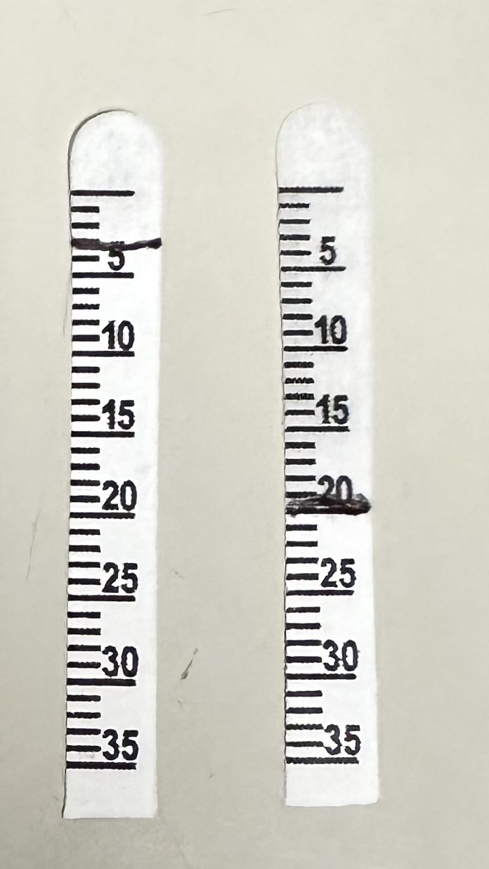 <p>Schirmer Test Results