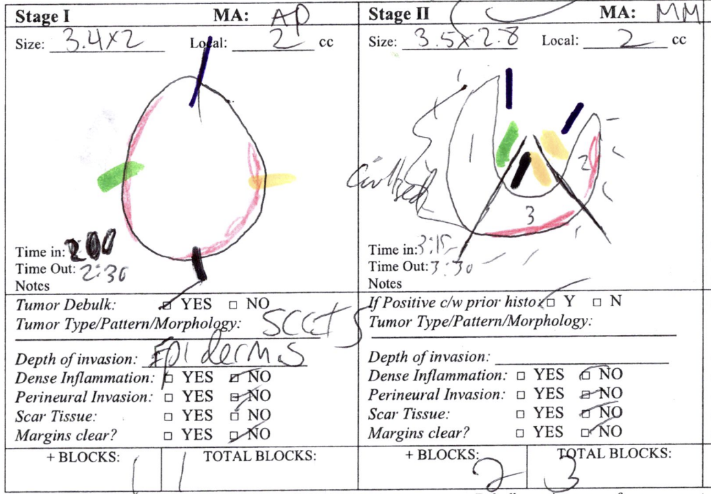 <p>Subdivided Mohs Layer