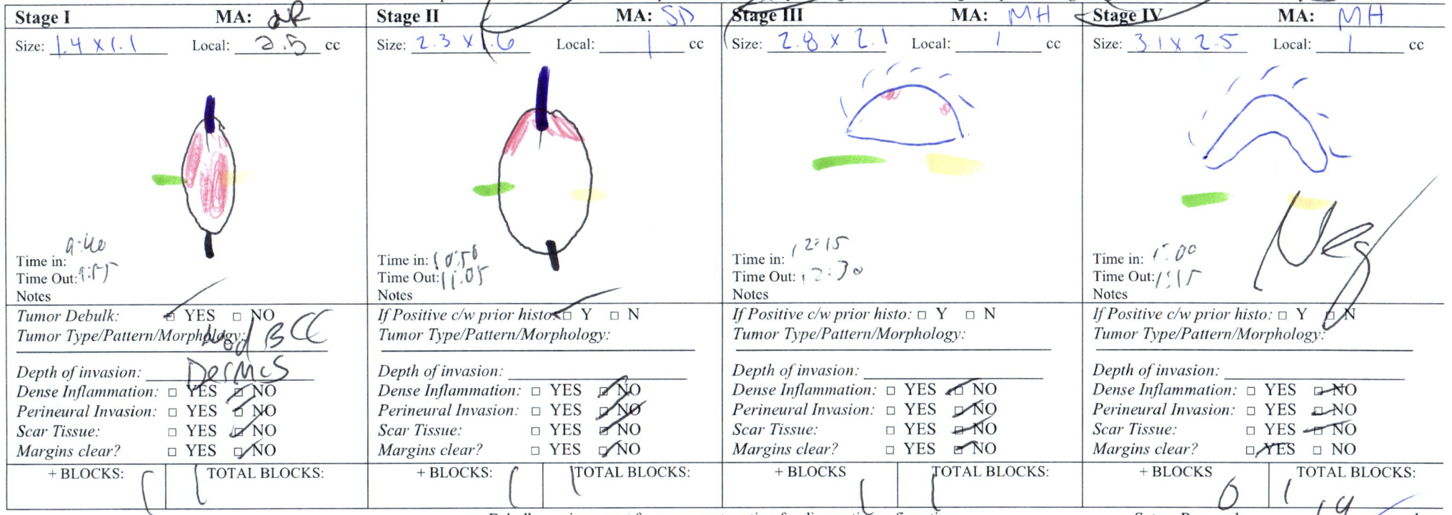 <p>4-Stage Mohs Map