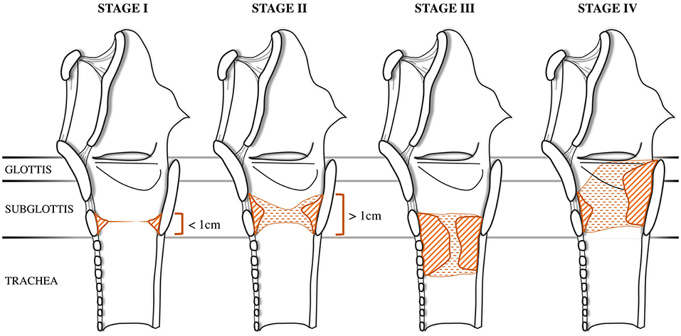 <p>McCaffrey Classification