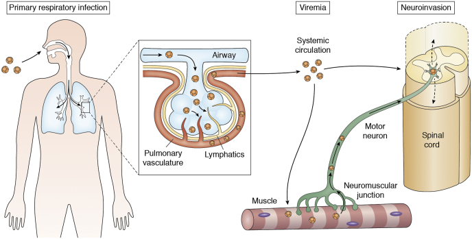 <p>Hypothesized Mechanisms of Neuroinvasion of Enterovirus D68