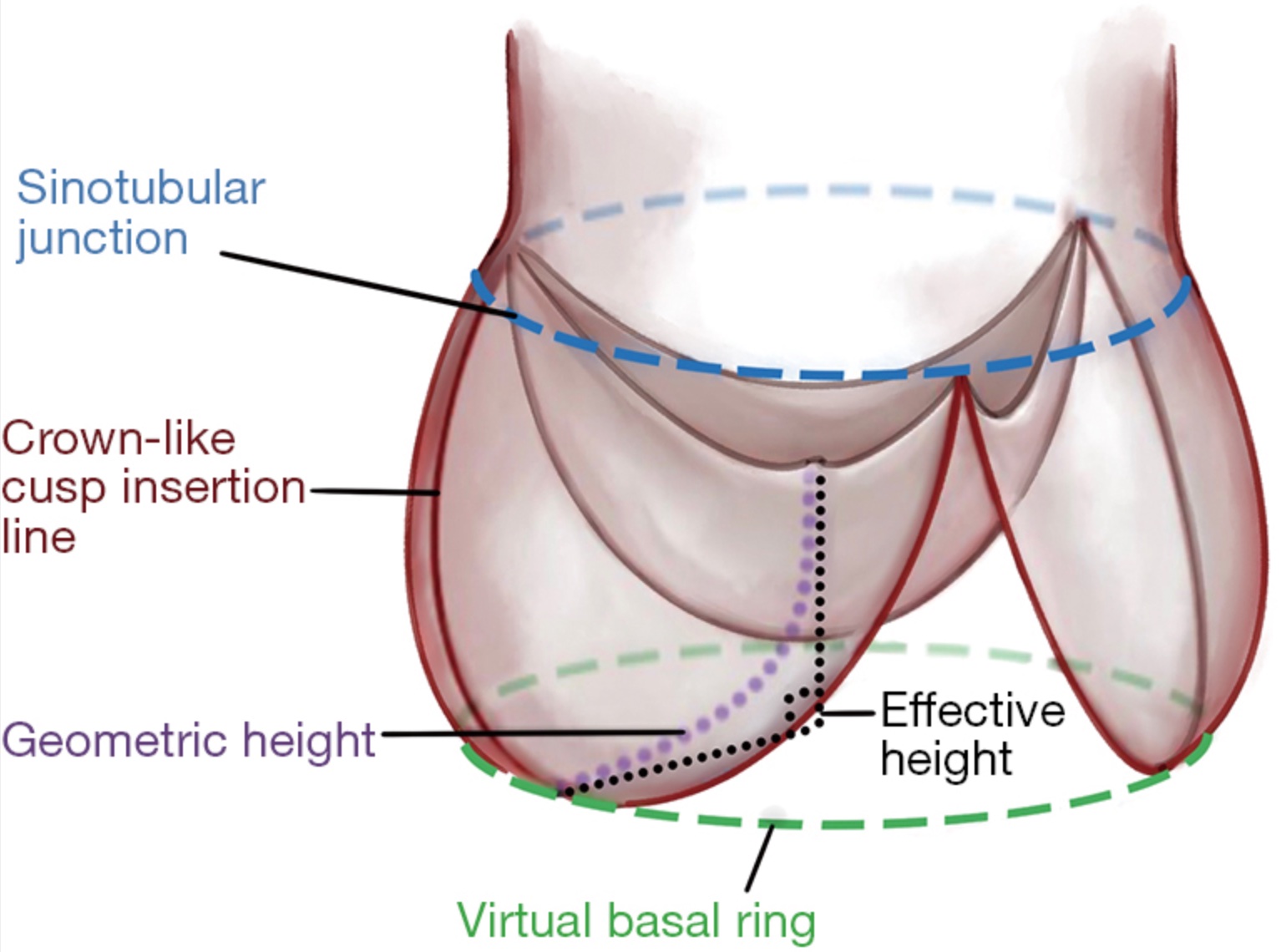 <p>Schematic Illustration of Geometric and Effective Height