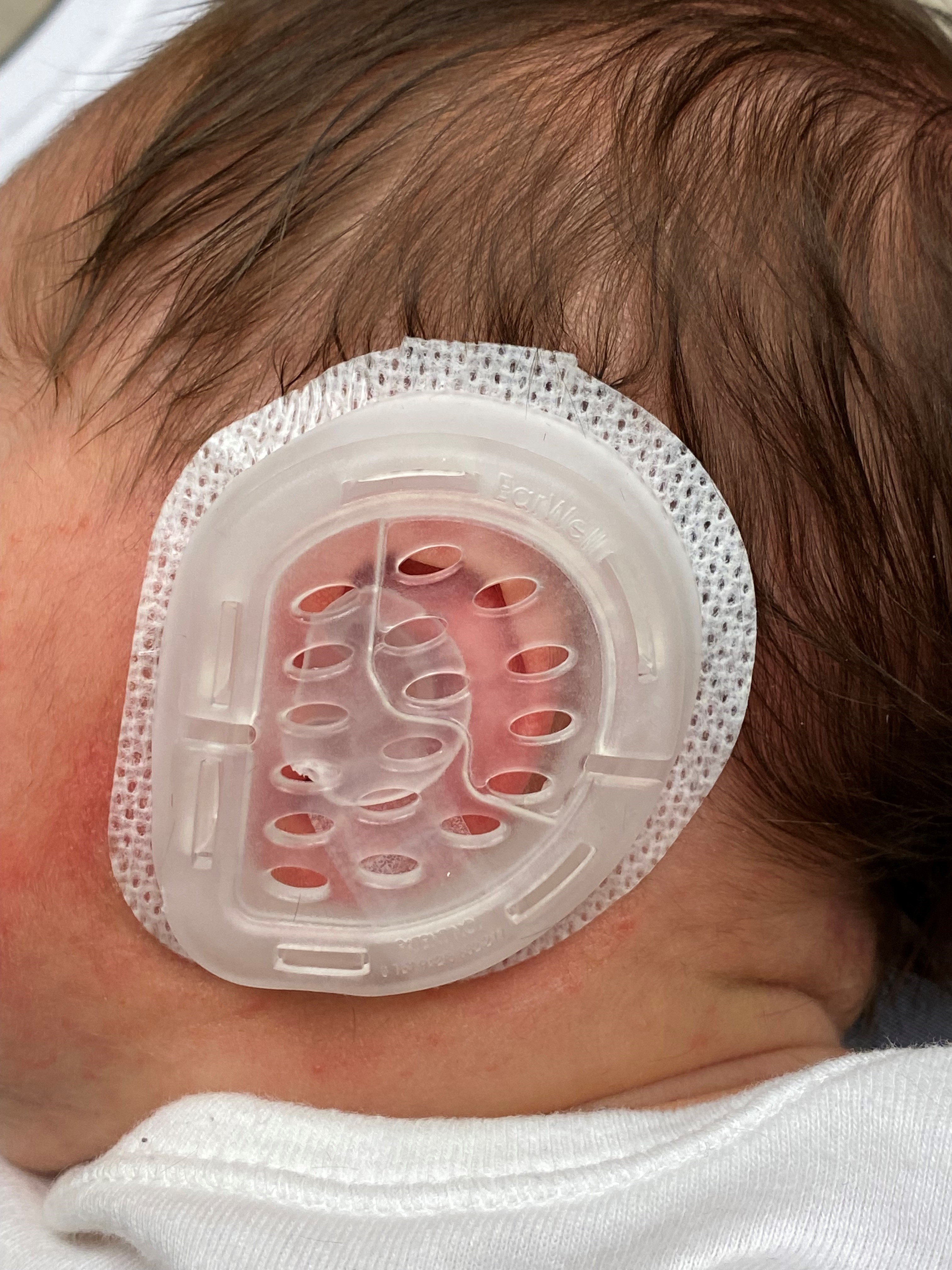 <p>Ear Molding