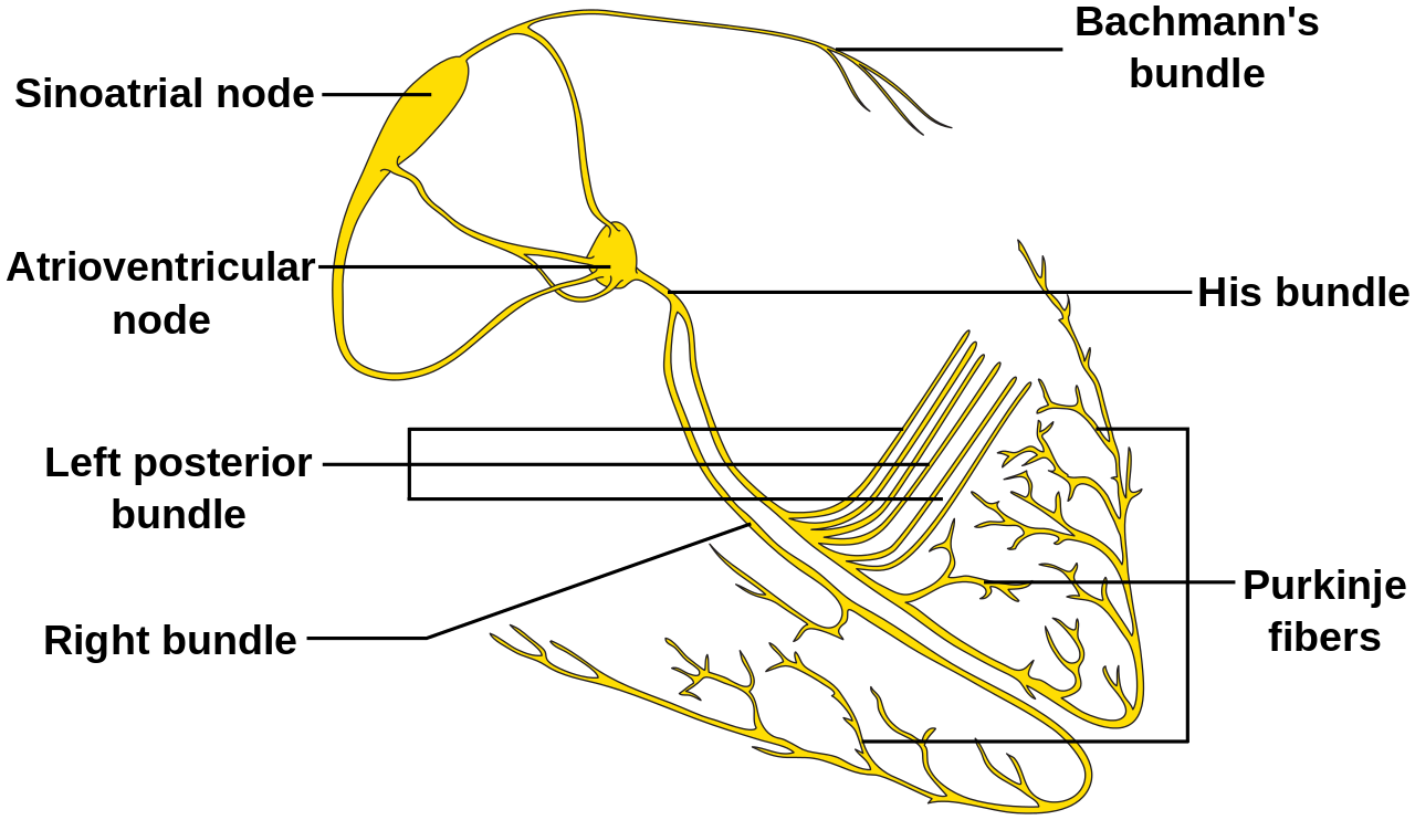 A graphical representation of the Electrical conduction system of the heart showing the Sinoatrial node, Atrioventricular nod