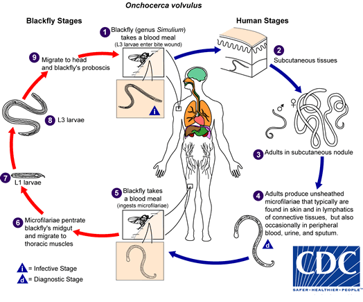 <p>Life Cycle of <em>Onchocerciasis volvulus.</em> Onchocerciasis volvulus causes Onchocerciasis or river blindness.</p>