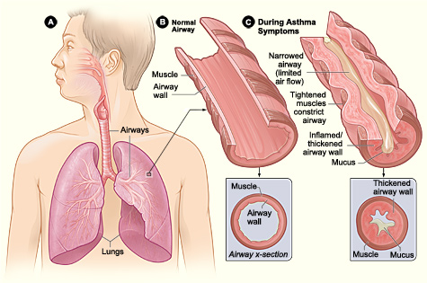 Figure A shows the location of the lungs and airways in the body