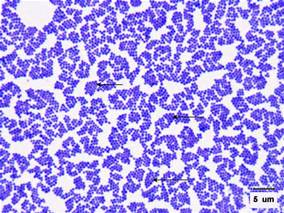 <p>Gram Stain of <em>Staphylococcus aureus</em></p>