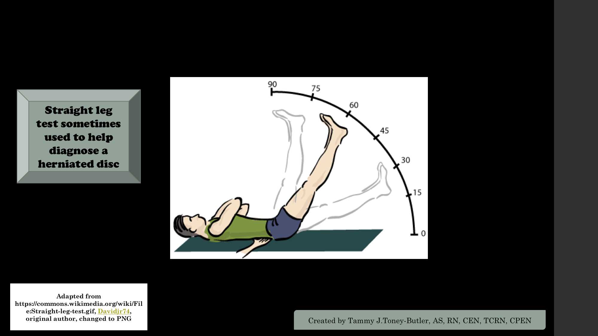 Straight Leg Test sometimes used to help diagnose a herniated disc