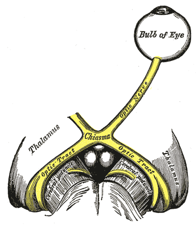 <p>The left optic nerve and the optic tracts