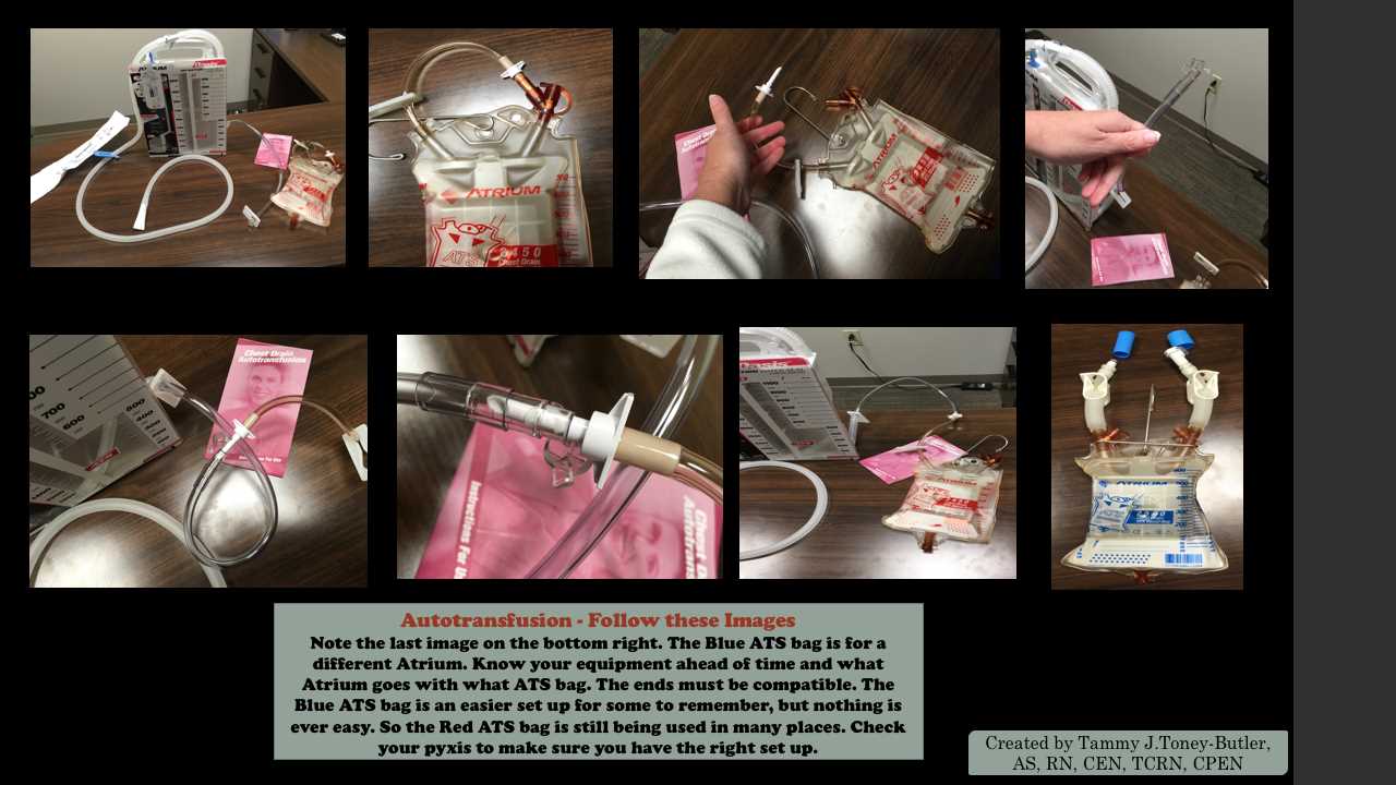 <p>Autotransfusion Set Up. ATS bags and atrium.</p>