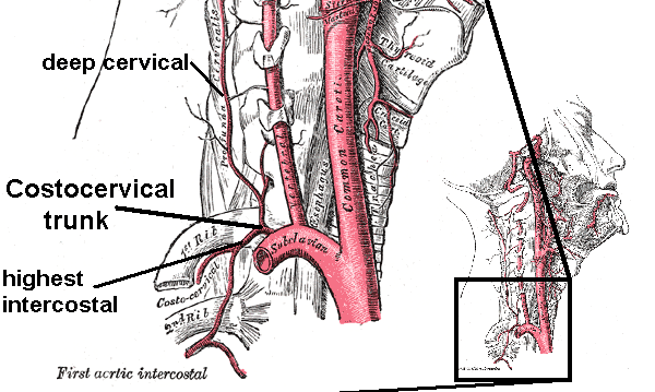 Costocervical trunk with branches. Right side. Deep Cervical Artery