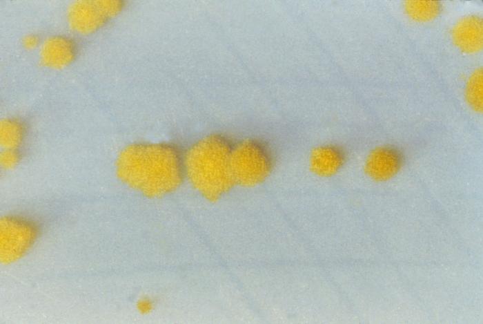 <p><em>Clostridioides difficile</em> Cultures on Cycloserine Mannitol Agar