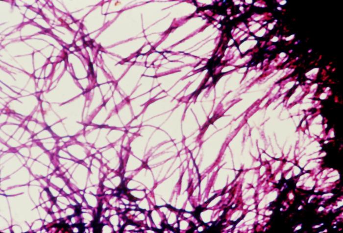 <p>Impression Smear of <em>Clostridioides difficile