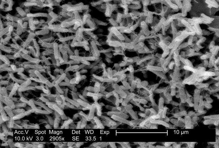 <p>Micrograph of <em>Clostridioides difficile</em> Showing Colitis