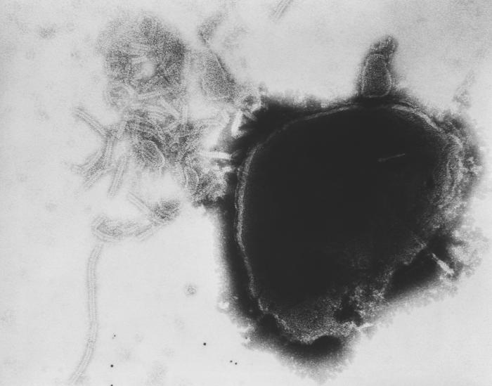Pathology, Transmission electron micrograph, (TEM), Paramyxovirus virion, viral nucleocapsids, Measles, Mumps, Rubella, Vacci