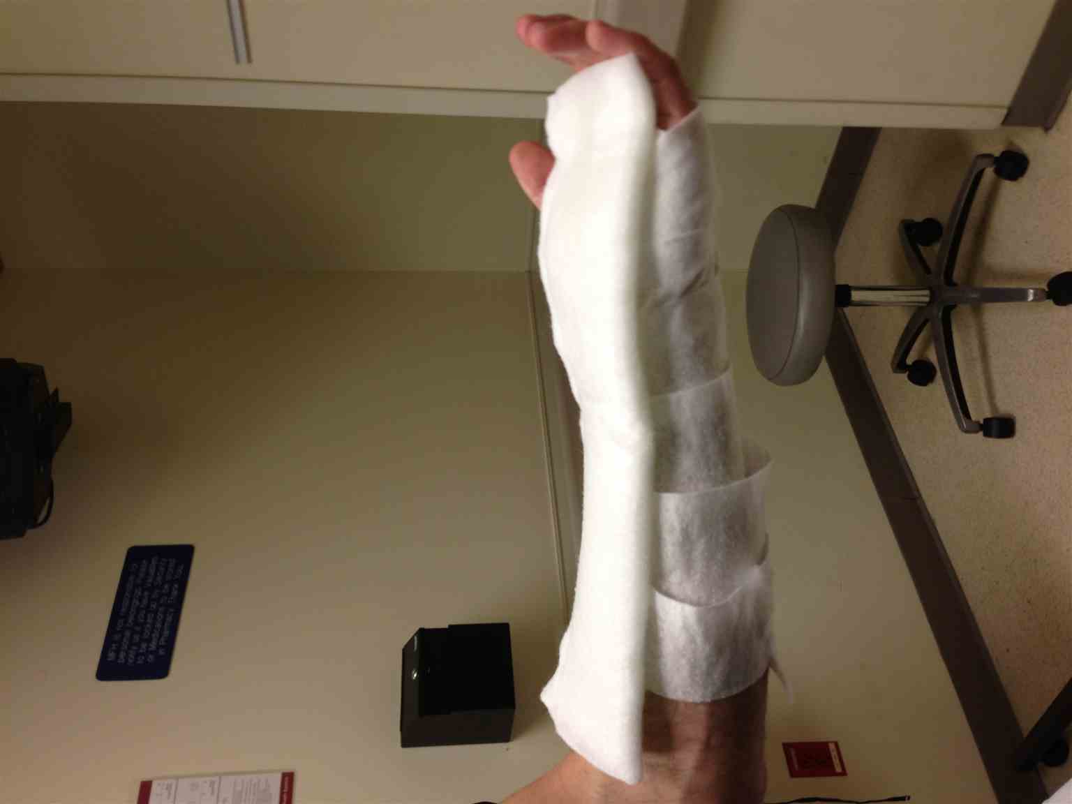 <p>Volar Splint Side View</p>