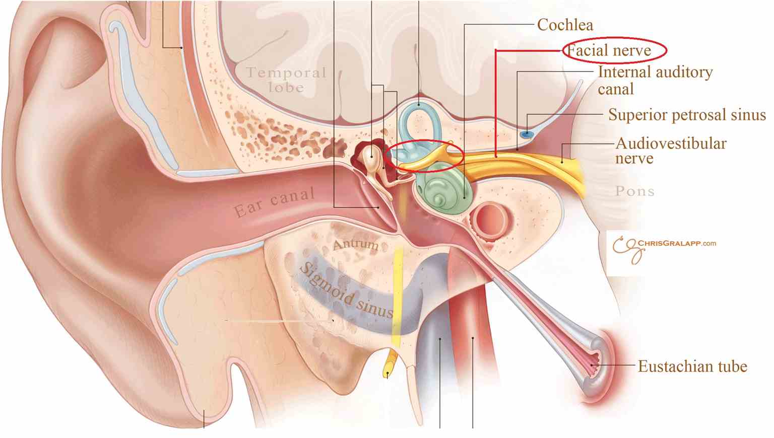 Facial Nerve in Middle Ear