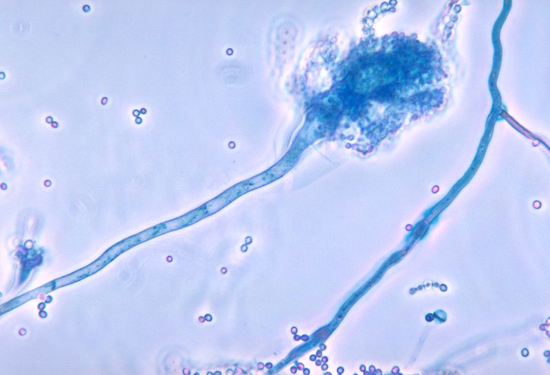 <p><em>Aspergillus Fumigatus</em></p>