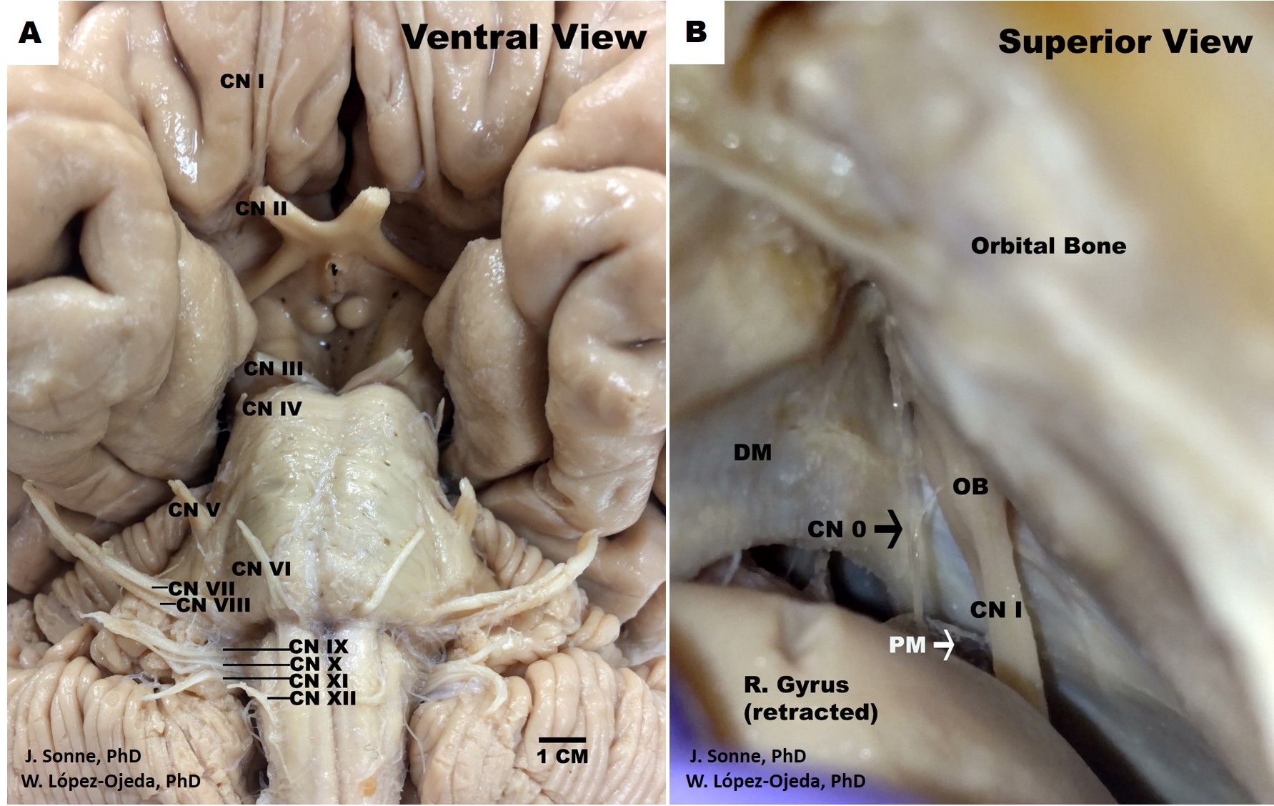 Figure 1A-B