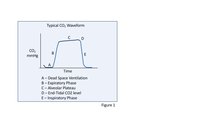 <p>CO2 Waveform</p>