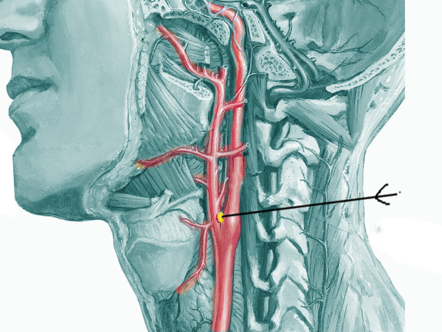 carotid body