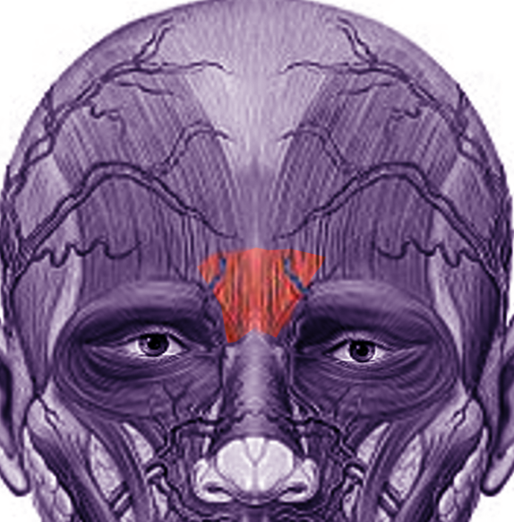 Procerus muscle