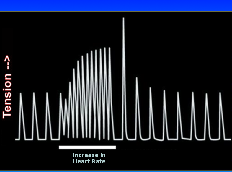 Bowditch phenomenon