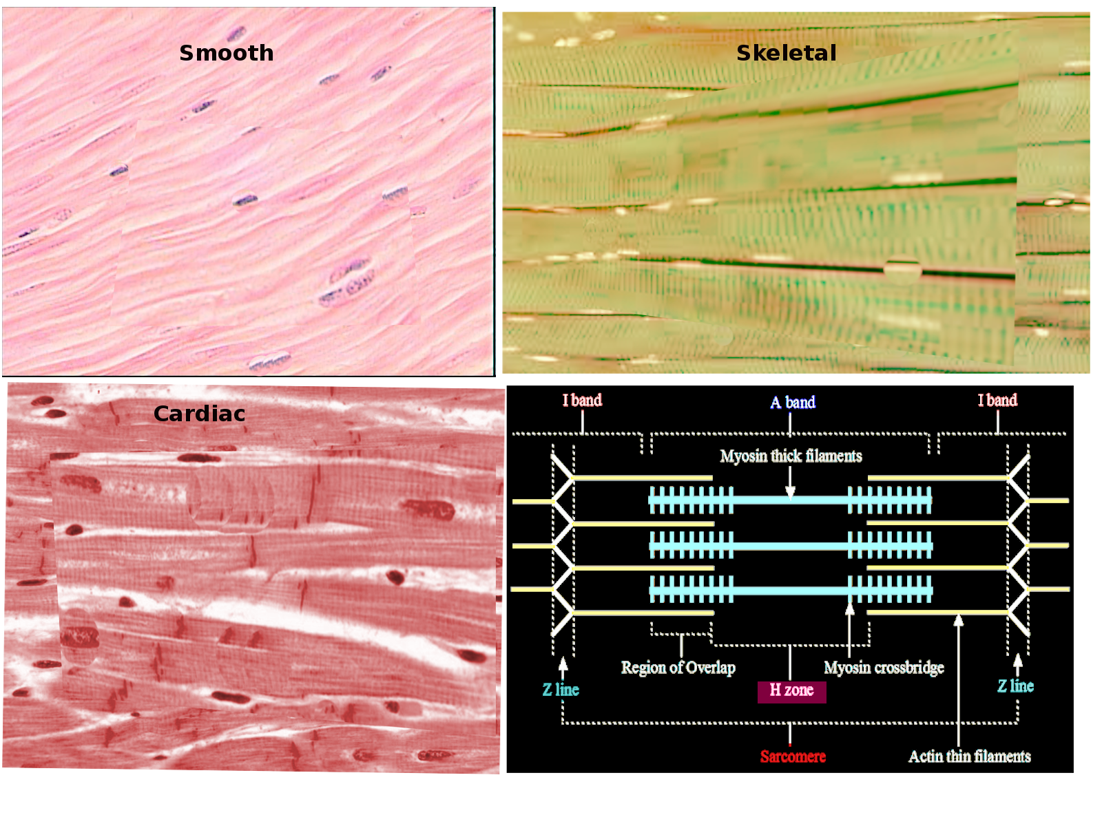 Muscle Types