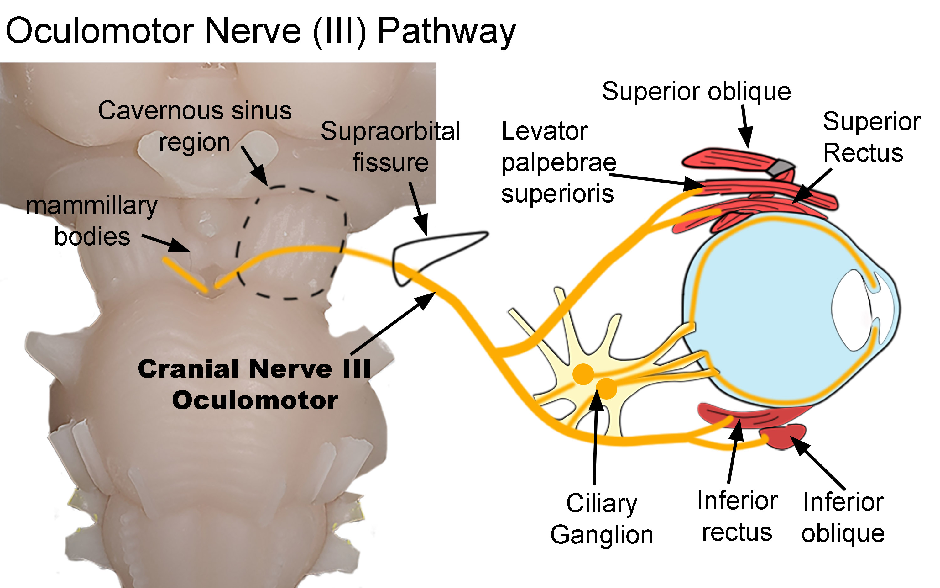 <p>Oculomotor Nerve Pathway