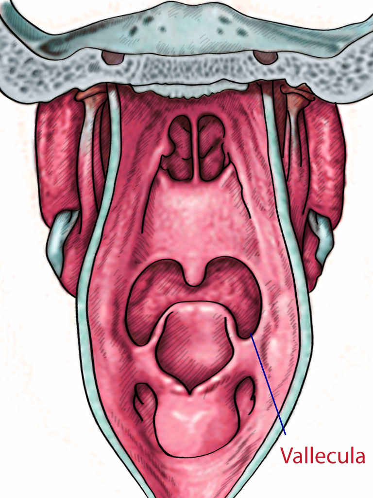 <p>Vallecula</p>