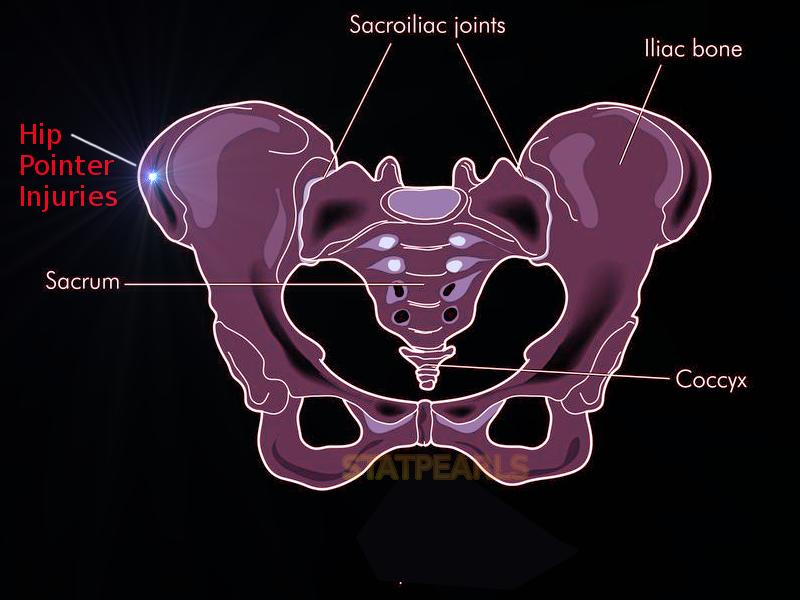 Hip Pointer Injuries