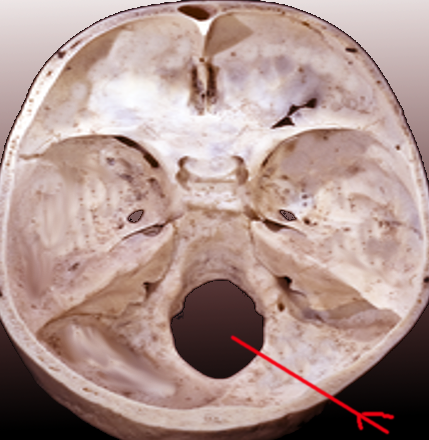 Foramen magnum