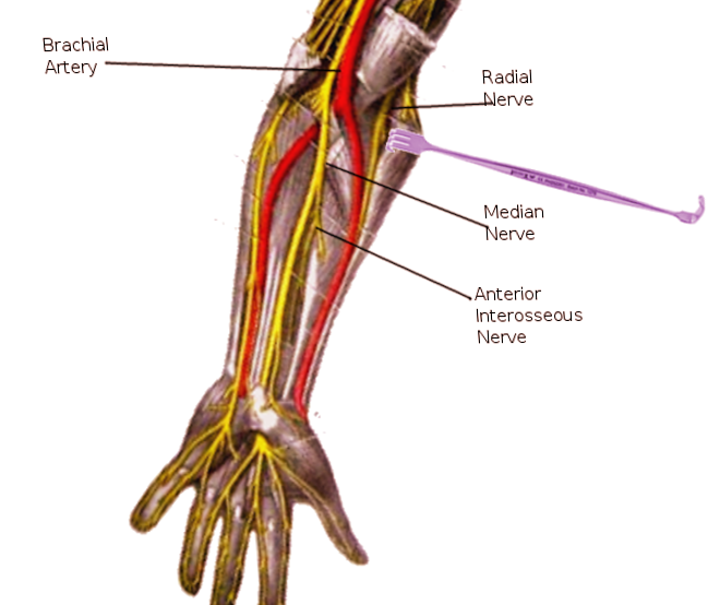 Anterior Interosseous Nerve