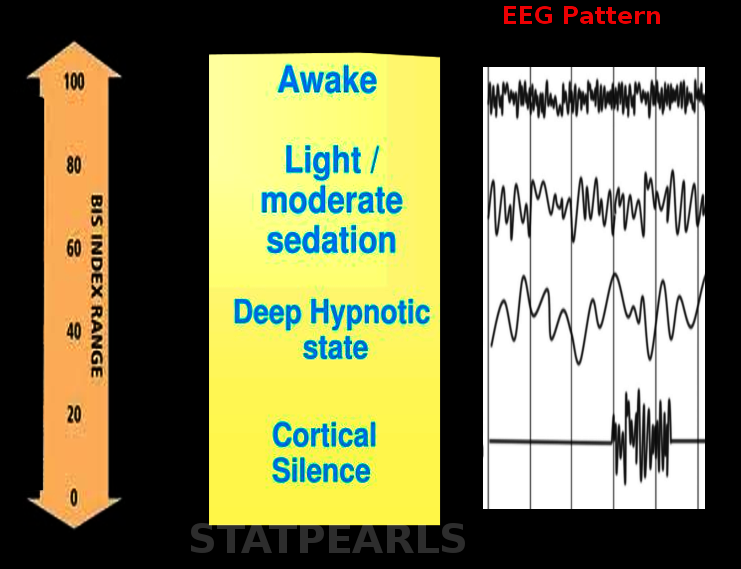 <p>Bispectral Index</p>