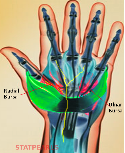<p>Hand Bursae. Shown in this illustration are the radial bursa and ulnar bursa.</p>