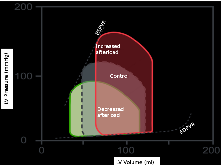 <p>Cardiac Preload</p>