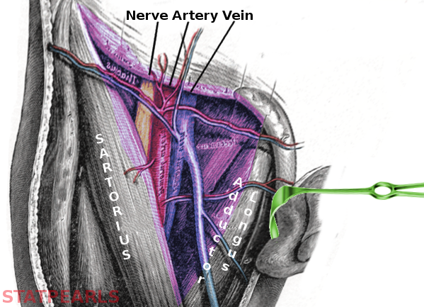 <p>Femoral Triangle</p>